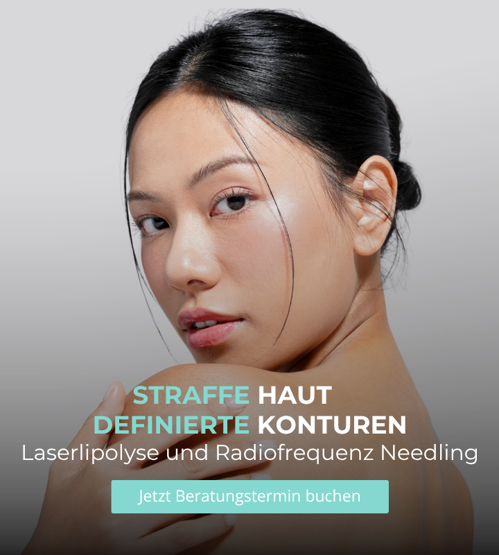 Laserlipolyse und Radiofrequenz Needling in Wiesbaden bei California Skin